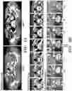 Fig. 10 - METHODS FOR TREATING COLORECTAL CANCER