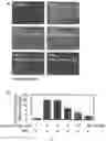 Fig. 04 - COMPOSITION FOR PREVENTING OR TREATING FINE DUST-INDUCED RESPIRATORY DISEASE COMPRISING MIXTURE (RGX-365) COMPRISING GINSENOSIDES RG2, RG4, RG6 AND RH1, AS ACTIVE INGREDIENT, AND PREPARATION METHOD THEREOF