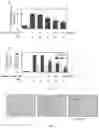 Fig. 06 - COMPOSITION FOR PREVENTING OR TREATING FINE DUST-INDUCED RESPIRATORY DISEASE COMPRISING MIXTURE (RGX-365) COMPRISING GINSENOSIDES RG2, RG4, RG6 AND RH1, AS ACTIVE INGREDIENT, AND PREPARATION METHOD THEREOF