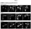 Fig. 14 - Method and compositions for treating Coronavirus infection