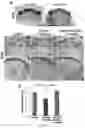 Fig. 13 - MIR-181 INHIBITORS AND USES THEREOF