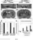 Fig. 14 - MIR-181 INHIBITORS AND USES THEREOF