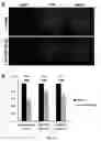Fig. 21 - MIR-181 INHIBITORS AND USES THEREOF
