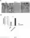 Fig. 31 - MIR-181 INHIBITORS AND USES THEREOF
