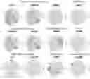 Fig. 01 - SINGLE-NUCLEI CHARACTERIZATION OF AMYOTROPHIC LATERAL SCLEROSIS FRONTAL CORTEX