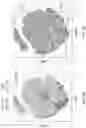 Fig. 10 - SINGLE-NUCLEI CHARACTERIZATION OF AMYOTROPHIC LATERAL SCLEROSIS FRONTAL CORTEX