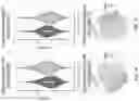 Fig. 14 - SINGLE-NUCLEI CHARACTERIZATION OF AMYOTROPHIC LATERAL SCLEROSIS FRONTAL CORTEX