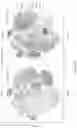 Fig. 40 - SINGLE-NUCLEI CHARACTERIZATION OF AMYOTROPHIC LATERAL SCLEROSIS FRONTAL CORTEX
