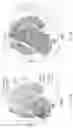Fig. 43 - SINGLE-NUCLEI CHARACTERIZATION OF AMYOTROPHIC LATERAL SCLEROSIS FRONTAL CORTEX