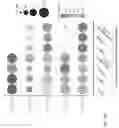 Fig. 67 - SINGLE-NUCLEI CHARACTERIZATION OF AMYOTROPHIC LATERAL SCLEROSIS FRONTAL CORTEX