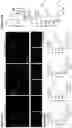 Fig. 41 - METHODS OF TREATMENT OF DISEASES AND DISORDERS ASSOCIATED WITH INCREASED TET LEVEL, INCREASED H19 LEVEL, INCREASED LEVEL OF TGF SIGNALING, OR ANY COMBINATION THEREOF
