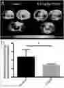 Fig. 01 - Derivatized chitosan polymers and methods of treating vascular disorders