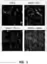 Fig. 02 - Derivatized chitosan polymers and methods of treating vascular disorders