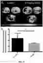 Fig. 05 - Derivatized chitosan polymers and methods of treating vascular disorders
