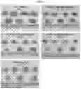 Fig. 07 - Activated lymphocytes comprising cytokine-induced killer cells and preparation method therefor