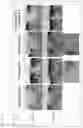 Fig. 27 - COMPOSITION FOR PROMOTING CARTILAGE TISSUE REGENERATION