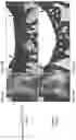 Fig. 04 - MIXED-CELL GENE THERAPY