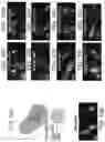 Fig. 12 - Engineered parasites for delivering protein to the central nervous system (CNS)