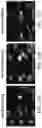 Fig. 14 - Engineered parasites for delivering protein to the central nervous system (CNS)
