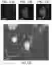 Fig. 15 - Engineered parasites for delivering protein to the central nervous system (CNS)