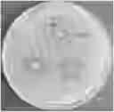 Fig. 01 - seed extract composition and its application in antibiotic-resistant infections