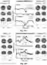 Fig. 17 - Anti-Psychotic Composition and Treatment Methods