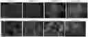Fig. 01 - COMPOSITIONS AND METHODS FOR PROTECTING TYPE 2 ALVEOLAR EPITHELIAL CELLS (AEC2)