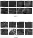 Fig. 03 - COMPOSITIONS AND METHODS FOR PROTECTING TYPE 2 ALVEOLAR EPITHELIAL CELLS (AEC2)