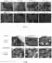 Fig. 04 - COMPOSITIONS AND METHODS FOR PROTECTING TYPE 2 ALVEOLAR EPITHELIAL CELLS (AEC2)