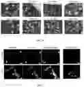 Fig. 05 - COMPOSITIONS AND METHODS FOR PROTECTING TYPE 2 ALVEOLAR EPITHELIAL CELLS (AEC2)