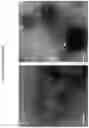 Fig. 13 - NEUTRALIZING VACCINES AGAINST HUMAN CORONAVIRUS