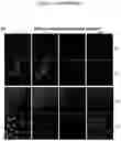 Fig. 16 - NEUTRALIZING VACCINES AGAINST HUMAN CORONAVIRUS