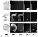 Fig. 14 - Modulation of tumor immunity by protein-mediated Odelivery