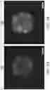 Fig. 14 - Sustained release formulations using non-aqueous membrane emulsification