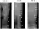 Fig. 03 - Treatment Of Intervertebral Disc Degeneration