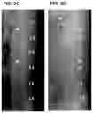 Fig. 07 - Treatment Of Intervertebral Disc Degeneration