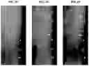 Fig. 15 - Treatment Of Intervertebral Disc Degeneration