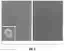 Fig. 04 - Compositions and methods for promoting islet viability and enhancing insulin secretion