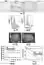 Fig. 03 - GLUCOSE-RESPONSIVE INSULIN DELIVERY MICRONEEDLE SYSTEM