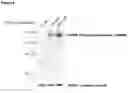 Fig. 10 - NEOANTIGEN ENGINEERING USING SPLICE MODULATING COMPOUNDS