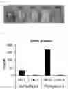 Fig. 04 - ANTISENSE NUCLEIC ACID TARGETING PCSK9