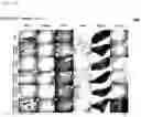 Fig. 80 - CP2C-TARGETING PEPTIDE-BASED ANTICANCER AGENT