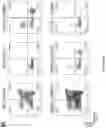 Fig. 04 - OPTIMISED RAG1 DEFICIENT GENE THERAPY