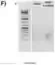 Fig. 21 - OPTIMISED RAG1 DEFICIENT GENE THERAPY