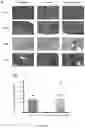 Fig. 25 - OPTIMISED RAG1 DEFICIENT GENE THERAPY