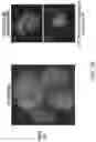 Fig. 04 - Gene therapy vectors for treating heart disease