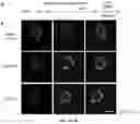 Fig. 06 - Method for stimulating axonal regeneration