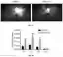 Fig. 13 - Method for stimulating axonal regeneration