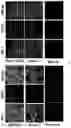 Fig. 08 - PEPTIDE PET/SPECT PROBES SPECIFIC TO ONCOPROTEINS IN TUMOR EXTRACELLULAR MATRIX