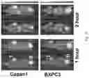 Fig. 11 - PEPTIDE PET/SPECT PROBES SPECIFIC TO ONCOPROTEINS IN TUMOR EXTRACELLULAR MATRIX